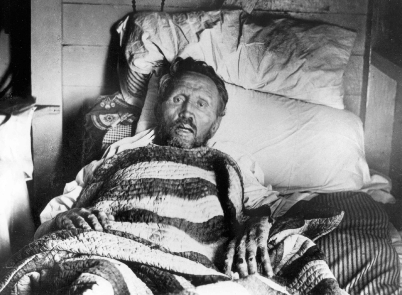 Father_Damien_on_his_deathbed_resize