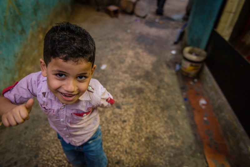 bambino siriano che porta i segni della guerra