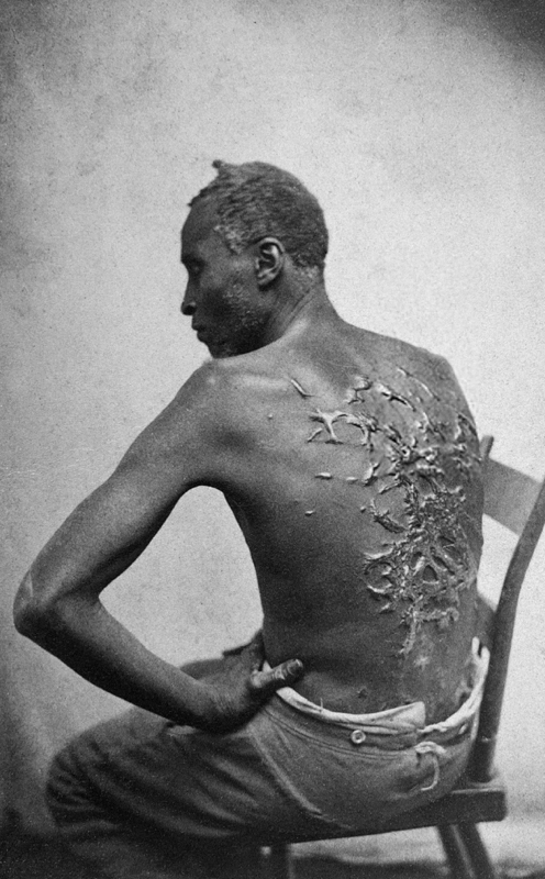 SCHIAVO-flagellato-Scourged_back_by_McPherson_&_Oliver,_1863,_retouched_resize