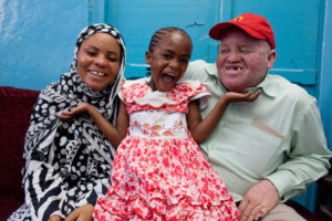 Il primo parlamentare albino del Tanzania: Salum Khalfan Barwany - AFP PHOTO/Yasuyoshi CHIBA